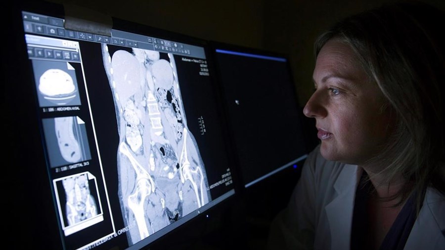 Canada: autre recul de l'espérance de vie en 2022, en particulier chez les femmes
