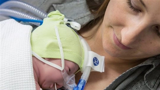 Un nouvel appareil pour prendre en charge les bébés en détresse respiratoire 