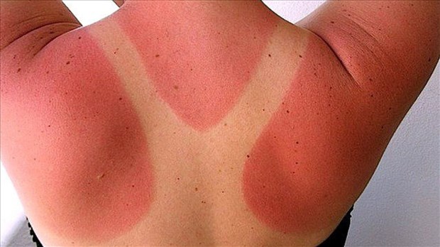 Une tendance TikTok met la santé des jeunes à risque