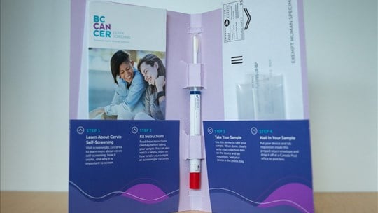 Hausse des décès du cancer du col de l'utérus chez les 35-44 ans au Canada